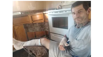 Help James Recover After a Serious Motorcycle Accident