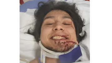 Help Anguel Get Back on His Feet After Motorcycle Accident