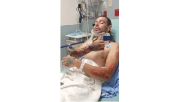 Help Ediecer (Edie) Recover After His Motorcycle Accident