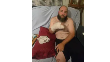 Help Alton Recover After His Motorcycle Accident